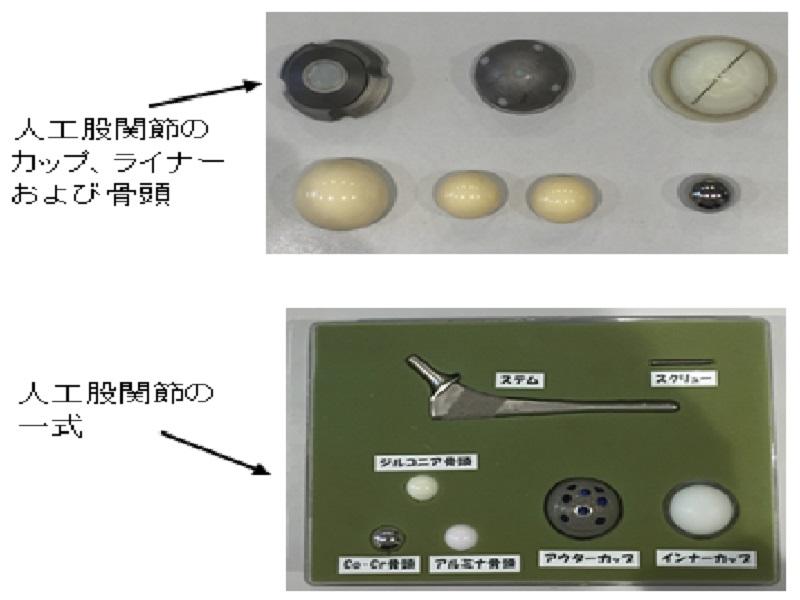 写真②：人工股関節のカップ、ライナーおよび骨頭、人工股関節の一式