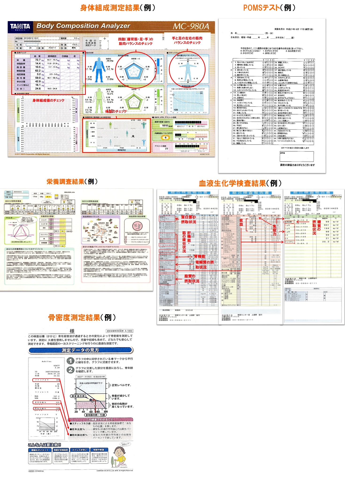 我々が目指すスポーツ障害の予防とスポーツ医科学サポート